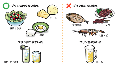 痛風の治療・予防