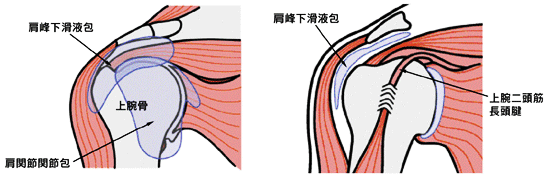 肩関節周囲炎とは